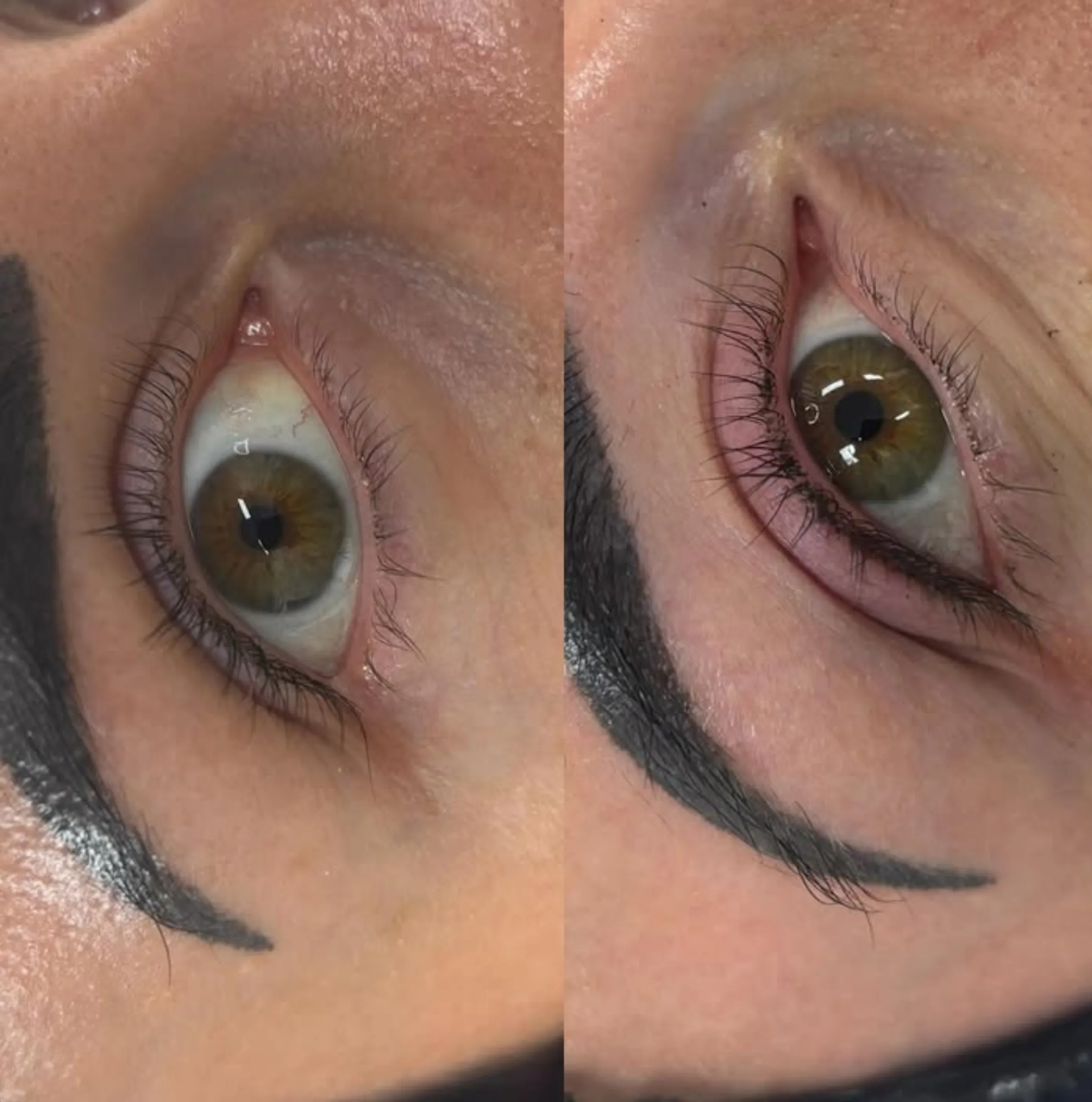 contact lenses after eyeliner tattoo