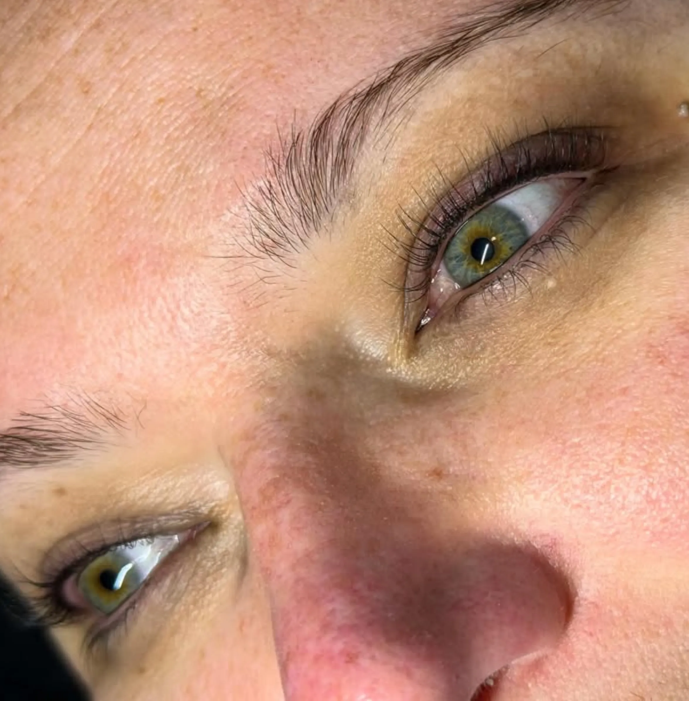 numbing cream and vision